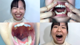Observation of Karina's mouth with plenty of saliva