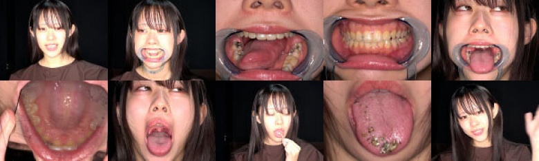 【激レア】「超貴重な口内・歯・のどちんこ観察＆小魚咀嚼巨大女プレイ！」甘井くるみ:イメージ画像