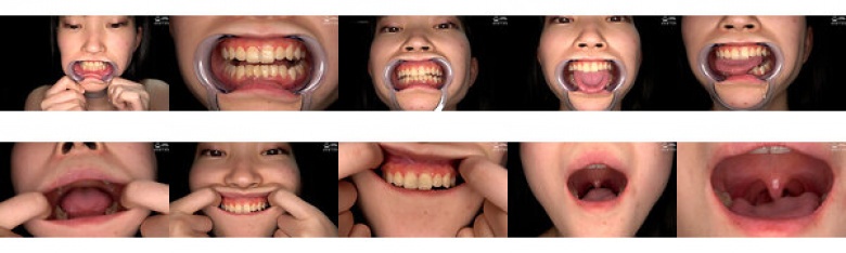 [牙齿/口腔] 超级受虐狂女孩的口腔、牙齿、喉咙内部的超罕见观察★ 日野伊织:样本图像