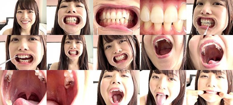 口内フェチ 〜歯＆舌ベロ＆口内観察〜 宮沢ちはる:イメージ画像