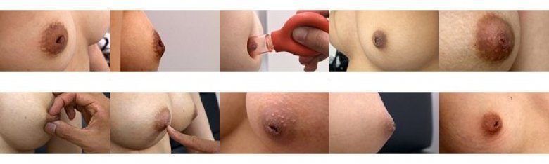 陥没乳首コンプレックス:イメージ画像