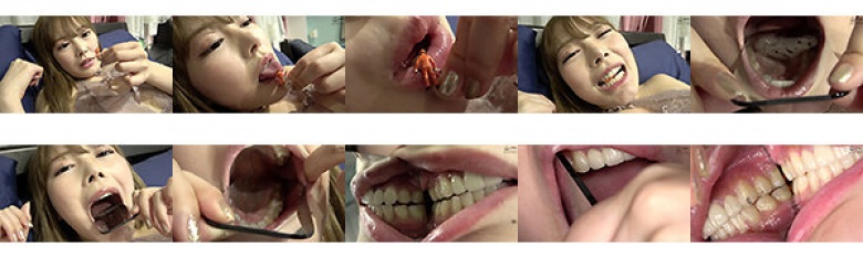 恋口癖～牙齿和口腔的牙科观察～然然:样本图像