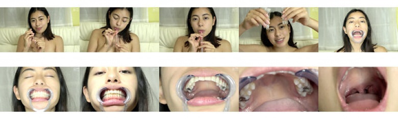 歯・唾・口内・のどちんこ観察 Emily:イメージ画像