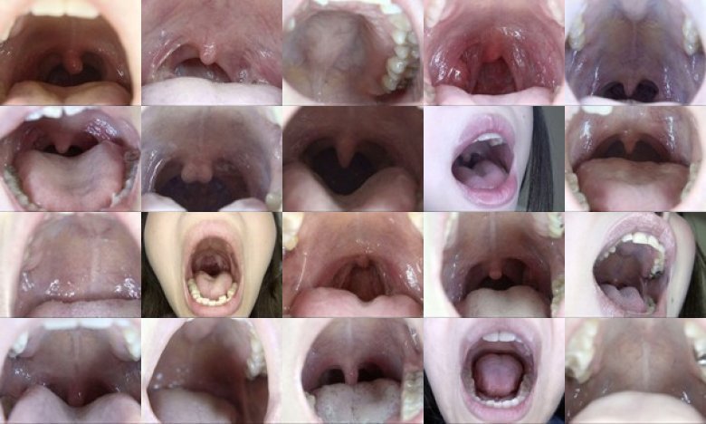 100人のおくち 第5集:イメージ画像