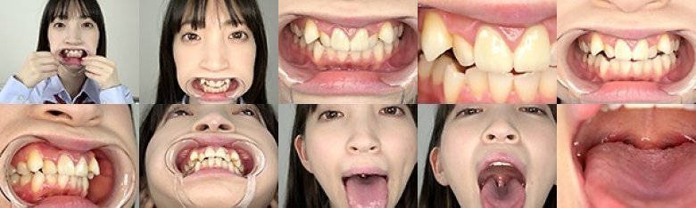 口内フェチ 〜歯・のどちんこ・舌ベロ観察〜 冬愛ことね:样本图像