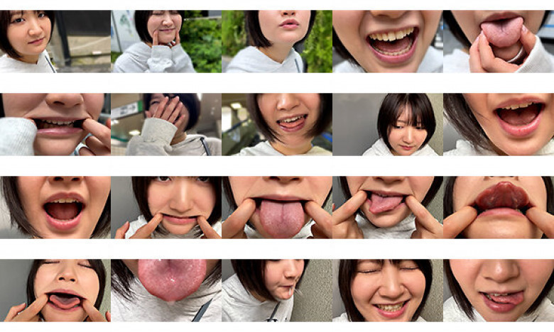 街角口内01:イメージ画像
