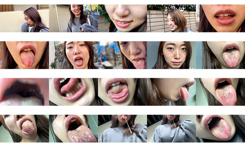 街角で声をかけて口内観察させてもらう 大学生 ゆゆちゃん:イメージ画像