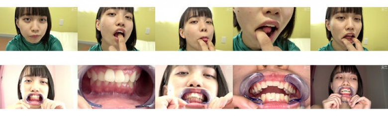 手指吹气和牙齿/嘴巴观察 Yukinoeru:样本图像